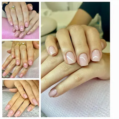 Beauty Clinic Mielec Depilacja laserowa, Ujędrnienie ciała, Zamykanie naczynek, Endermologia, TRIWINGS lampa LED